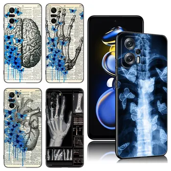 Радиологичен калъф за телефон за човешки органи за Xiaomi POCO X3 X4 NFC F5 M2 M3 M4 M6 X5 Pro F3 F4 GT 5G C31 C55 M5S черен капак