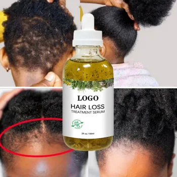 60ml Серум за бързо възстановяване на косата Черно семе Рициново масло за растеж на косата Гъста коса Бърз растеж за черни жени